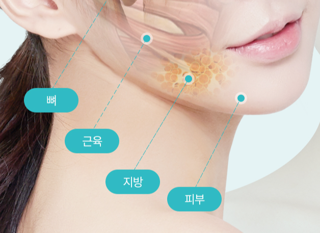 Facial Contouring Surgery for Improving Face Shape: Preparation for the Right Choice image 1