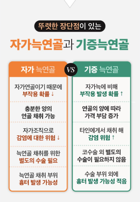 자가늑연골로 복코코끝성형 하는 방법은 관련 이미지 3