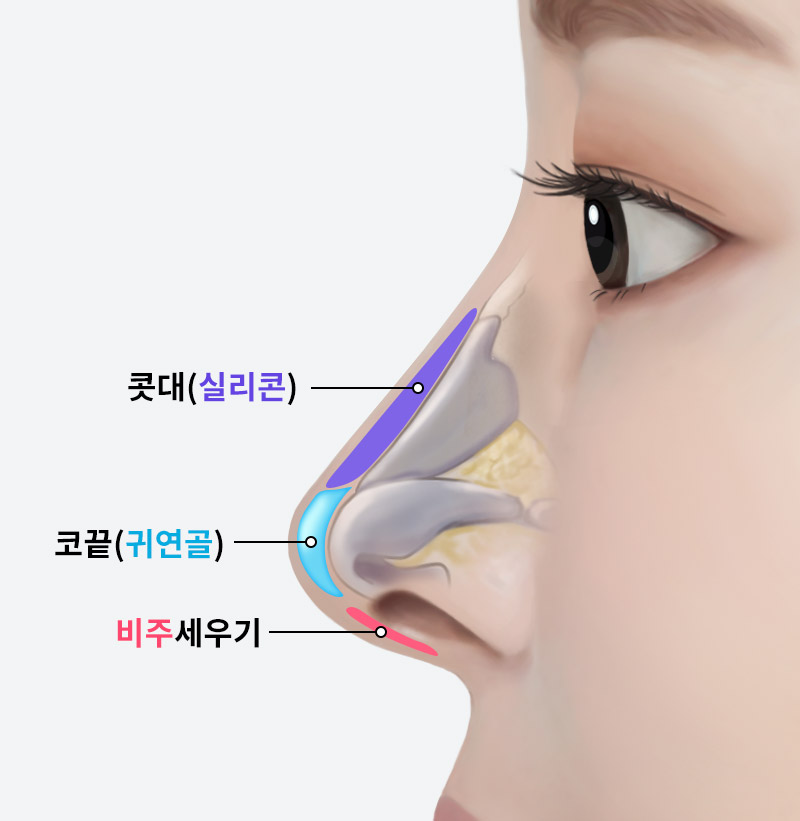 Natural Rhinoplasty That Refines the Nasal Tip with Ear Cartilage image 1