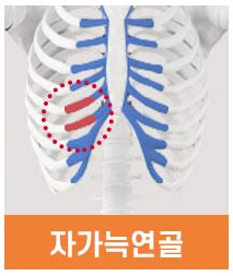 자가늑연골 코성형, 장점과 유의할 점은? 관련 이미지 2