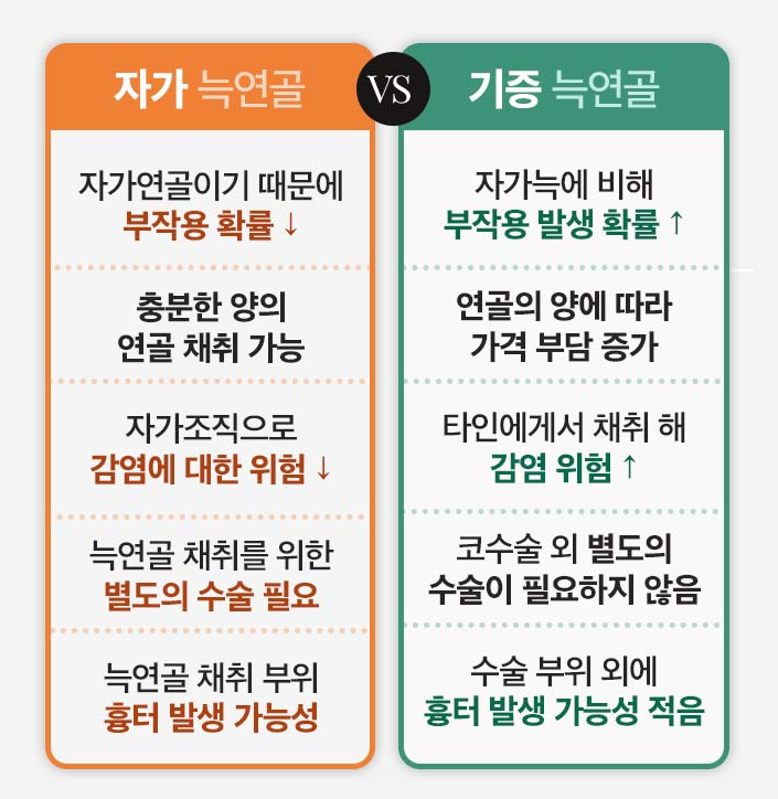 코재성형 자가늑 연골의 장점 관련 이미지 2