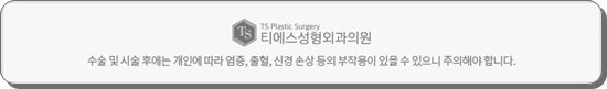 안면거상술의 비밀 그리고 안면거상 할 때 유의할 점이라면 관련 이미지 26