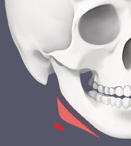 Differences in Preferred Contour Lines for Facial Contouring Surgery in Men and Women image 2