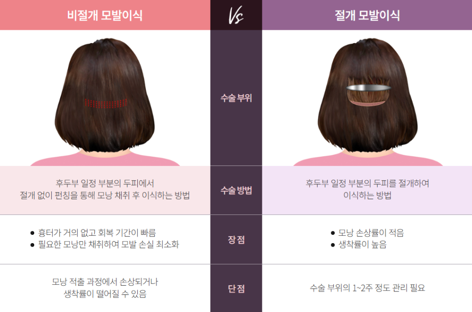 안면윤곽수술 후 헤어라인 교정과 모발이식이 필요한 이유는? 관련 이미지 7