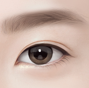 첫 수술 or 재수술, 자연유착 쌍꺼풀 고려할 점은? 관련 이미지 1