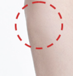 Forehead Fat Grafting: Considerations and Important Points image 1