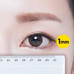 Canthoplasty and Lateral Canthoplasty to Soften the Eyes image 2