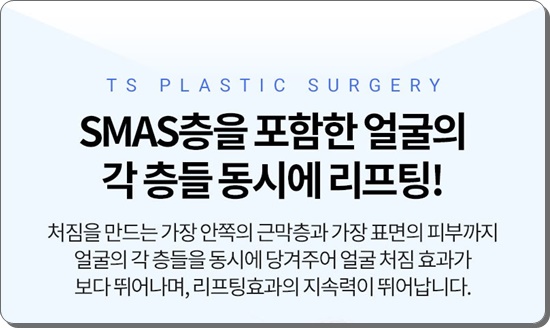 안면거상술의 비밀 그리고 안면거상 할 때 유의할 점이라면 관련 이미지 9