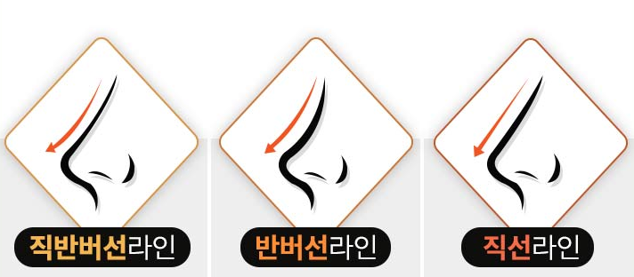 자연스러운 코재수술을 위한 맞춤형 접근법 관련 이미지 1