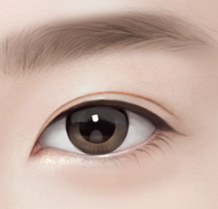 What Should You Check Before Undergoing a Non-Incisional Double Eyelid Surgery? image 2