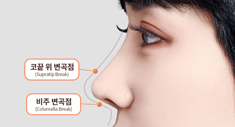 Rhinoplasty: Why Are Angle and Material Selection So Important? image 4