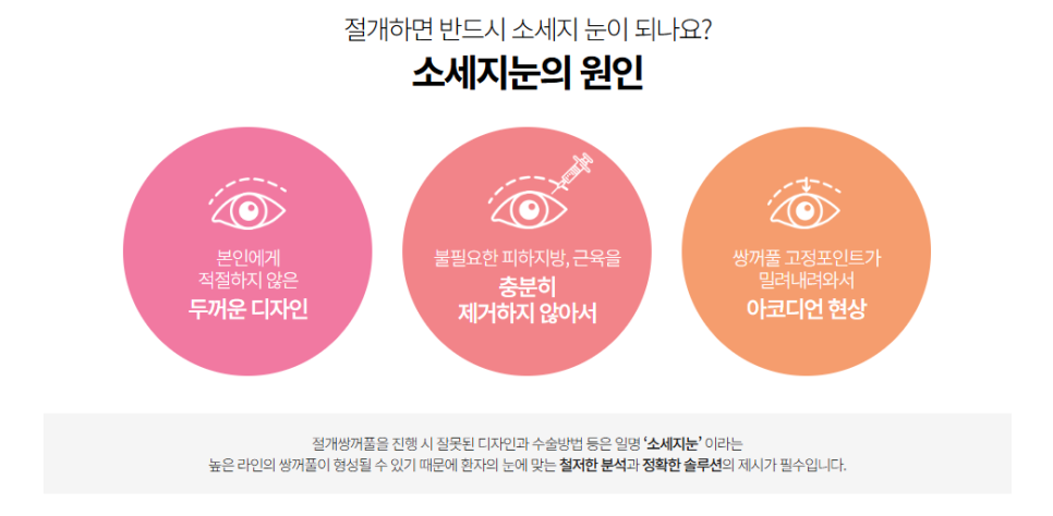 눈재수술 시 눈매교정이 꼭 필요할까? 관련 이미지 6