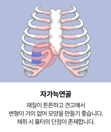 짧은코,들창코 이 경우 비중격 연장술이 꼭 필요할까? 관련 이미지 5