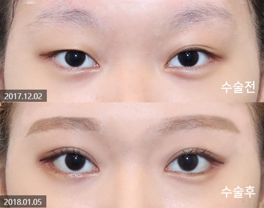 듀얼트임(뒤밑트임)이 효과적인 케이스는? 관련 이미지 5