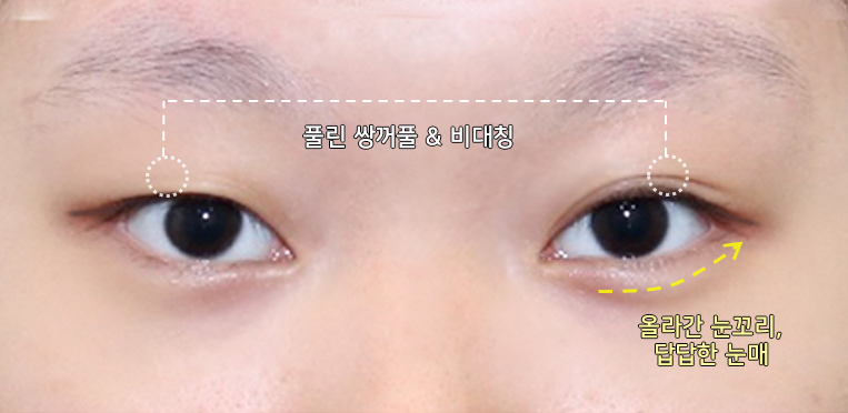 듀얼트임(뒤밑트임)이 효과적인 케이스는? 관련 이미지 3