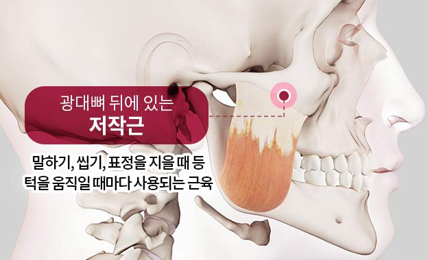 자연스러운 앞광대, 옆광대를 위한 광대축소 수술과 부작용 예방 방법 관련 이미지 1
