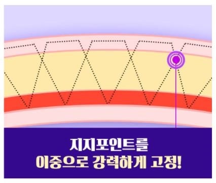 Changes and Causes That Can Occur When the Double Eyelid Line Becomes Weaker image 8