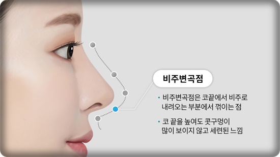 코성형, 얼굴 균형을 고려한 5가지 핵심 포인트 관련 이미지 4