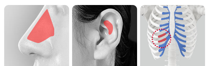 What to Consider for Your First Nose Surgery for a Natural Result image 2