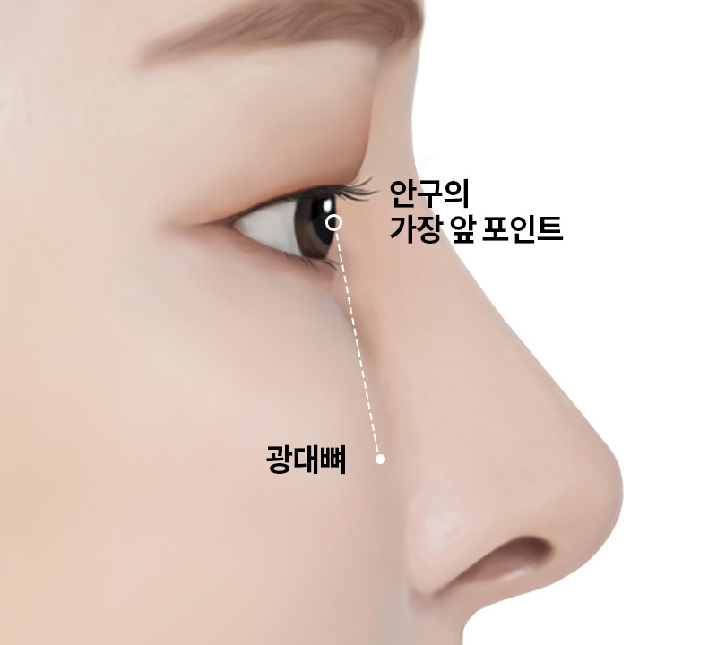 함몰눈은 어떻게 쌍꺼풀 수술을 해야 할까? 관련 이미지 1