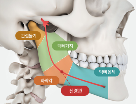 Facial Contouring Surgery: Is a Three-Area Procedure Really Necessary? image 3