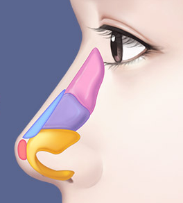 Non-Implant Rhinoplasty: How to Naturally Improve the Nose Line image 3