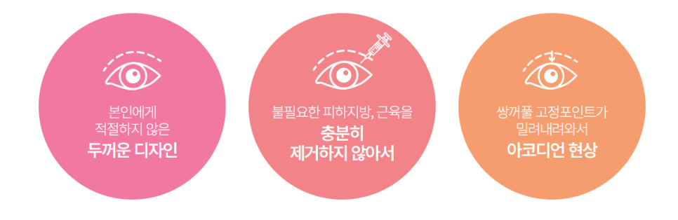 절개 쌍꺼풀 수술, 고려해야 할 사항은? 관련 이미지 2