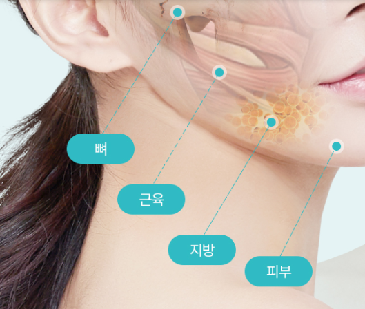 Facial Contouring: Various Considerations for Improving Face Shape image 1