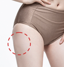 퓨어셀 지방이식이 얼굴 윤곽에 어떻게 도움이 될 수 있는지 알아보세요! 관련 이미지 3
