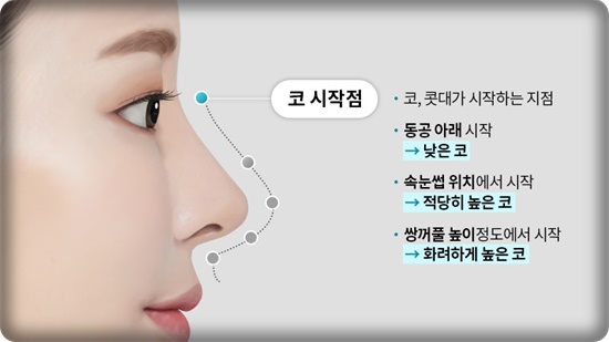 코성형, 얼굴 균형을 고려한 5가지 핵심 포인트 관련 이미지 1