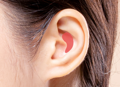 Natural Rhinoplasty That Refines the Nasal Tip with Ear Cartilage image 5