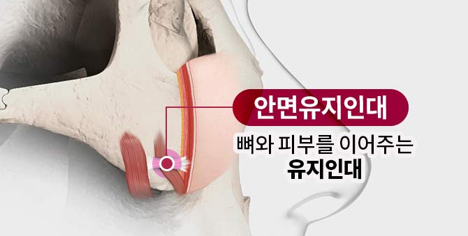 광대축소, 신중한 선택이 중요한 이유 관련 이미지 1