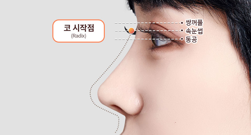 Rhinoplasty: Why Are Angle and Material Selection So Important? image 3