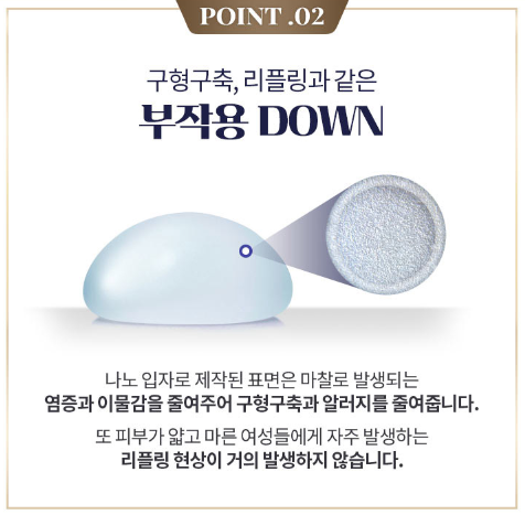 모티바가슴성형수술 알아봐야 할 정보 (촉감, 움직임과 모양) 관련 이미지 2