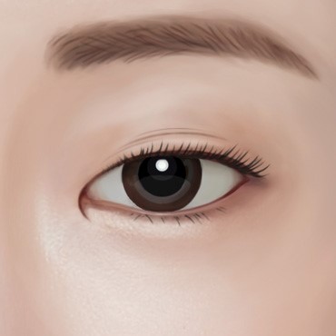 눈두덩이 꺼짐 겹주름눈 지방이식이 아닌 눈위지방재배치로 충분할까? 관련 이미지 1