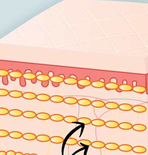 When Is Facial Fat Grafting Needed for Improved Facial Volume? image 3