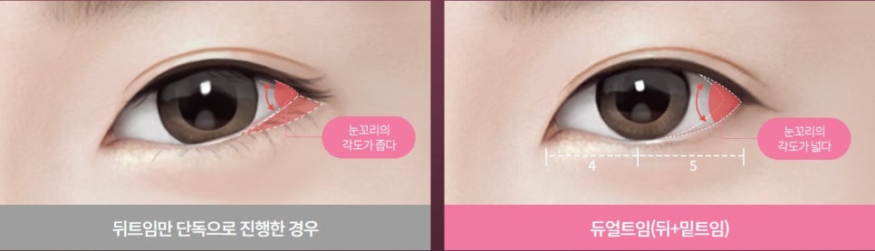 크고 시원한 눈매, 반드시 세미아웃라인이나 아웃라인이어야 할까요? 관련 이미지 1