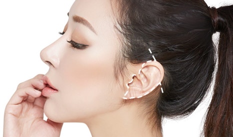 Facelift: Why the SMAS Layer Matters image 2