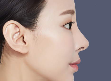 자가늑연골 코성형, 장점과 유의할 점은? 관련 이미지 1