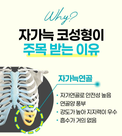 Rhinoplasty Without Implants: Is It Possible for Every Nose? Criteria to Check Before Surgery image 3