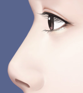 Considerations for Satisfying Results After Rhinoplasty image 3