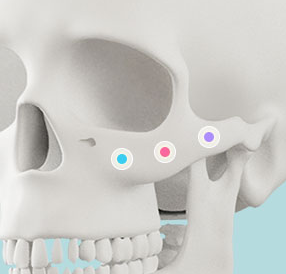 Things to Know About Contouring Surgery and Precautions image 3