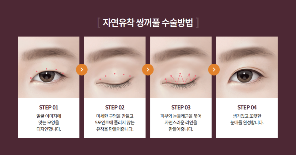 쌍꺼풀 수술 전, 쌍꺼풀 테이프는 언제부터 끊어야 할까요? 관련 이미지 2