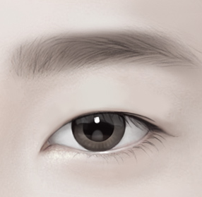 Rhinoplasty? No, Eye Surgery: The Right Approach for a Natural Result image 2