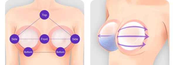 Breast Augmentation: Finding Natural Volume That Fits My Body image 5