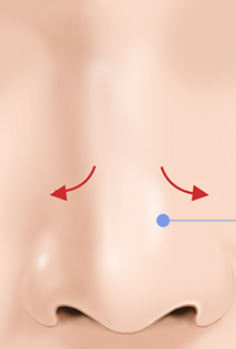 Considerations for Satisfying Results After Rhinoplasty image 1