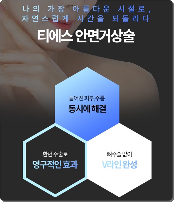 안면거상술의 비밀 그리고 안면거상 할 때 유의할 점이라면 관련 이미지 2