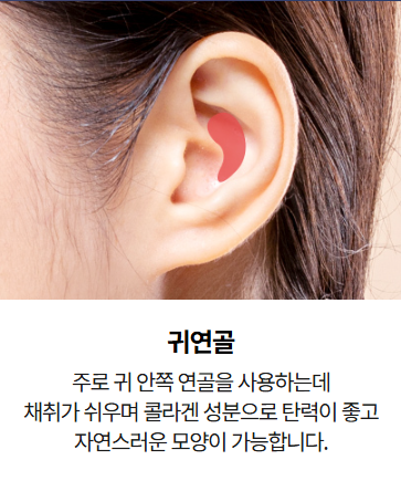 짧은코,들창코 이 경우 비중격 연장술이 꼭 필요할까? 관련 이미지 4