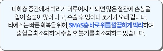 안면거상술의 비밀 그리고 안면거상 할 때 유의할 점이라면 관련 이미지 18