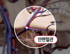 Facial Contouring Surgery for Improving Face Shape: Preparation for the Right Choice image 5